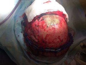 Neurocirujano en Quito